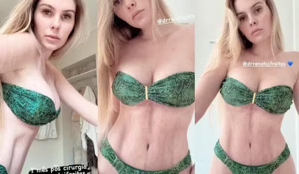 Bárbara Evans mostra resultado de cirurgias plásticas.(Imagem:Instagram)