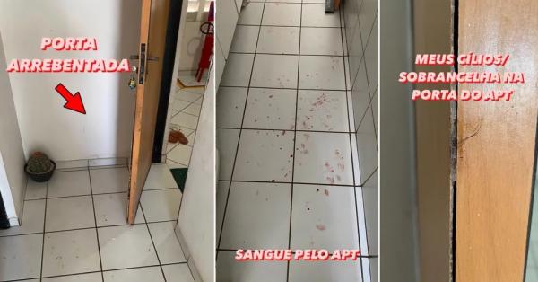  Jovem mostra o rosto coberto de sangue e denuncia agressões do namorado em Teresina; 