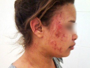 Estudante é baleada em tentativa de assalto na PI-114 em Campo Maior