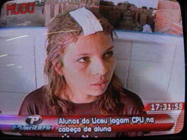 Aluna deu entrevista e mostrou como foi agredida(Imagem:Divulga&ccedil;&atilde;o)