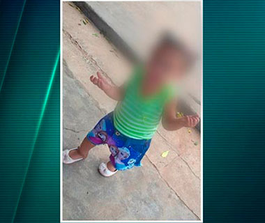 Criança feita de escudo pelo próprio pai tem alta da UTI, mas estado ainda é grave