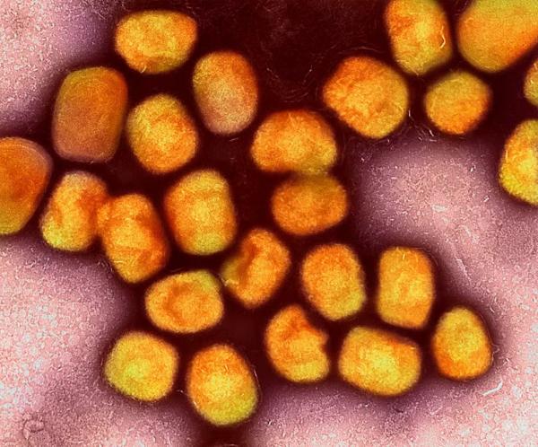 Mulher é internada com suspeita de mpox no Piauí, diz Sesapi; estado tem 40 casos confirmados da doe