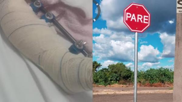 Menina de quatro anos é atropelada enquanto brincava na rua em Teresina