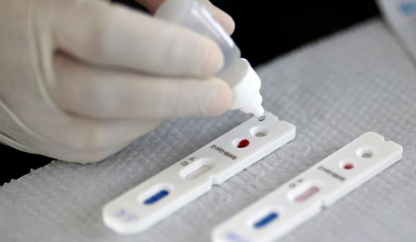 Piauí registra 18 novos casos de Covid-19 e nenhum óbito pela doença em 24 horas