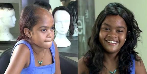 A adolescente recebeu a doa&ccedil;&atilde;o da pr&oacute;tese de um cabeleireiro, que se sensibilizou com a hist&oacute;ria da garotinha.(Imagem:TV Clube)