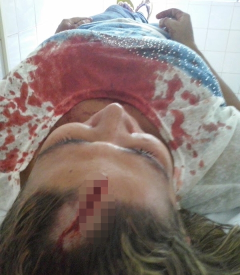 Jovem é agredida a paulada pelo próprio irmão no Piauí