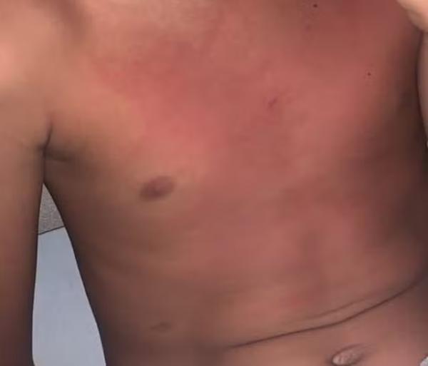 Mãe denuncia que professora mandou alunos agredirem seu filho em escola no PI