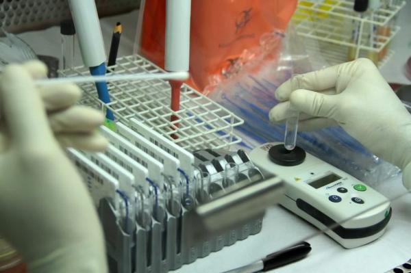 Coronavírus no Piauí: secretário de saúde explica demora no resultado de exames; estado tem 37 casos