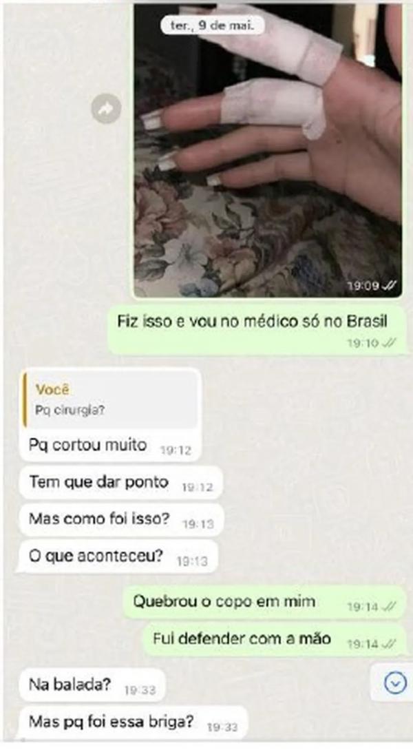 Gabriela Cavallin com ferimento em um dos dedos.(Imagem:Reprodu&ccedil;&atilde;o)