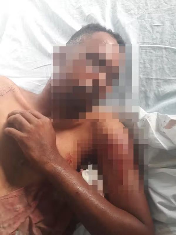 Homem é derrubado de bicicleta e atacado por cachorros em Batalha, no PI
