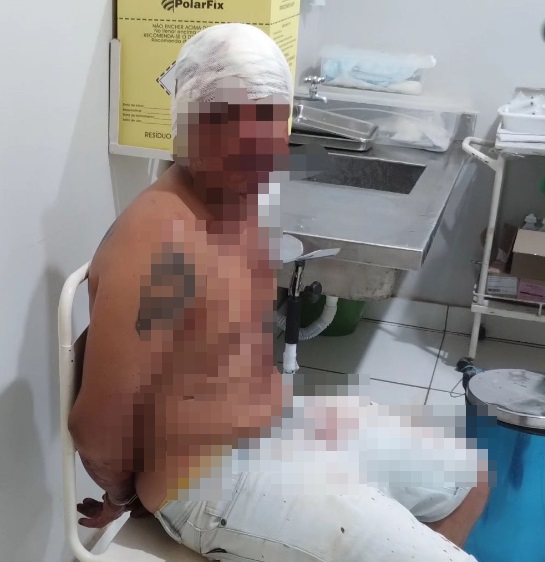 Homem é preso após agredir ex-companheira e ser golpeado pelo filho da vítima no PI