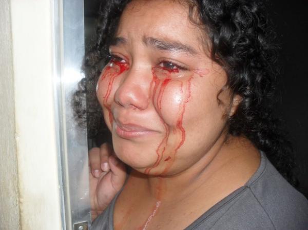 D&eacute;bora Oliveira dos Santos, de 17 anos, afirma sangrar pelos olhos quando fica nervosa. A foto acima foi tirada por uma prima da estudante durante uma de suas crises (Imagem:Diana Viana de Oliveira / Reprodu&ccedil;&atilde;o)