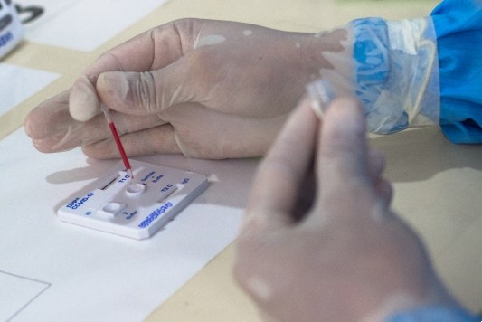 Casos de Covid-19 aumentam em 37% no Piauí; uma morte é registrada neste mês