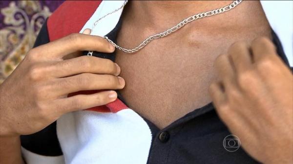 Zika v&iacute;rus tem como sintoma erup&ccedil;&otilde;es na pele e coceiras: especialistas estudam rela&ccedil;&atilde;o do zika com a s&iacute;ndrome de Guillain-Barr&eacute;.(Imagem:Reprodu&ccedil;&atilde;o / TV Globo)