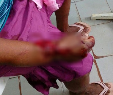 Idosa é agredida com barra de ferro ao ver suspeito de roubo em sua casa