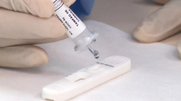 Piauí registra 664 casos de Covid-19 e 6 óbitos pela doença nas últimas 24 horas