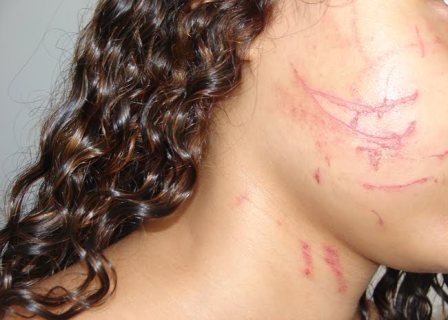 Conselho Tutelar resgata jovem de 15 anos após denúncia de agressão