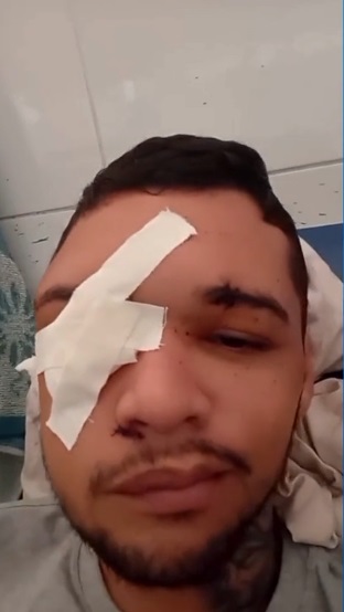 Jovem sobrevive a dois tiros na cabeça após ser confundido com irmão em Teresina