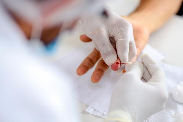 Teste de HIV já está sendo realizado nas UBSs de Floriano