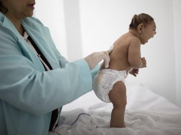 Piauí tem 87 casos confirmados de microcefalia, diz Ministério da Saúde