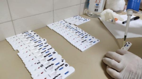 Piauí registra 515 casos e 22 mortes por Covid-19, em boletim parcial