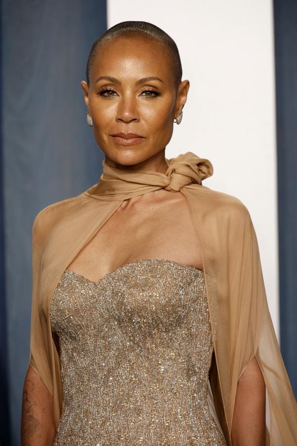 Alopecia: o que é a condição capilar que motivou agressão de Will Smith a Chris Rock no Oscar