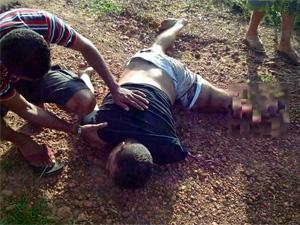 Motoqueiro tem braço e pé amputado após ser colhido por Gol na BR-343