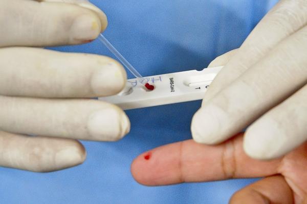 Piauí registra 165 casos confirmados e dois óbitos por Covid-19 nas últimas 24 horas