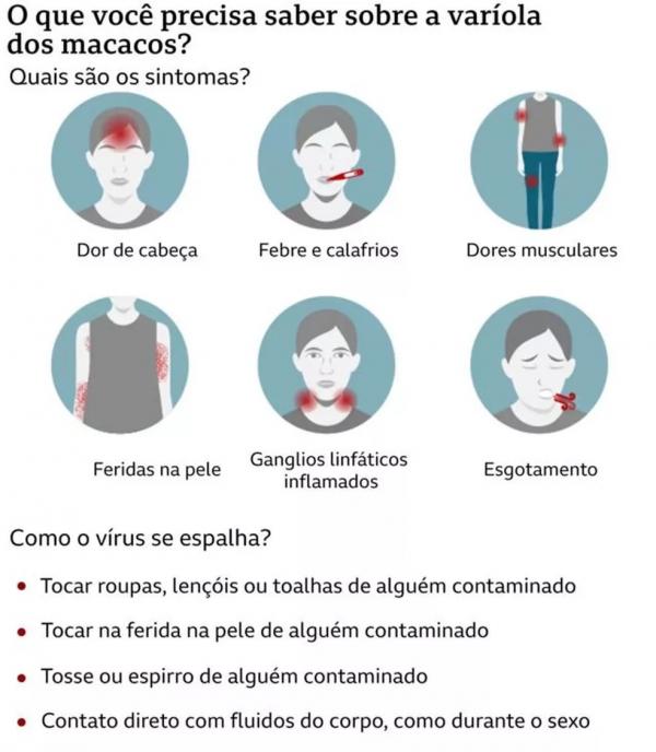  Infogr&aacute;fico mostra informa&ccedil;&otilde;es sobre transmiss&atilde;o e sintomas da var&iacute;ola dos macacos.(Imagem: BBC )