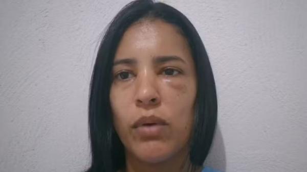 "Na cabeça dele não estou com ele por orgulho", diz secretária agredida por ex-namorado no Piauí