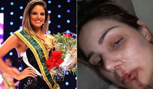 Ex-Miss Piauí fala pela 1ª vez e faz desabafo: