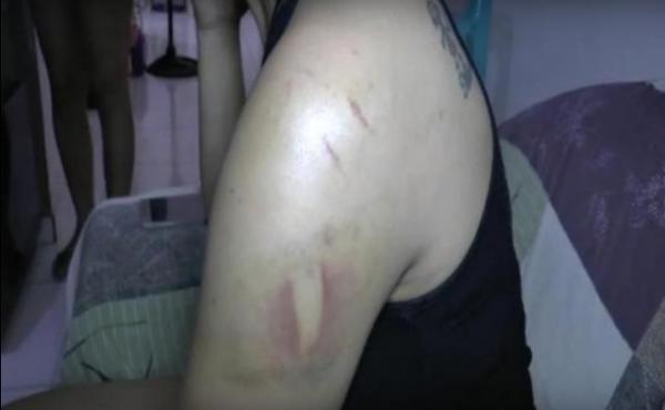 Vítima de espancamento fala sobre momentos de terror em cárcere privado