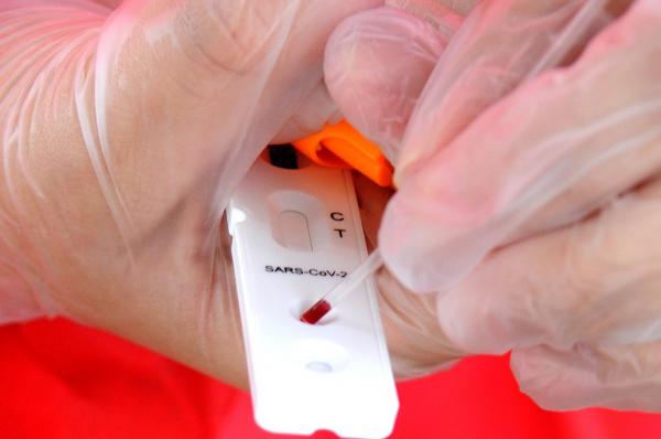 Piauí registra 83 casos confirmados e três óbitos por Covid-19 nas últimas 24 horas