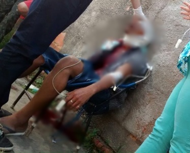 Homem baleado na cabeça morre no HTN