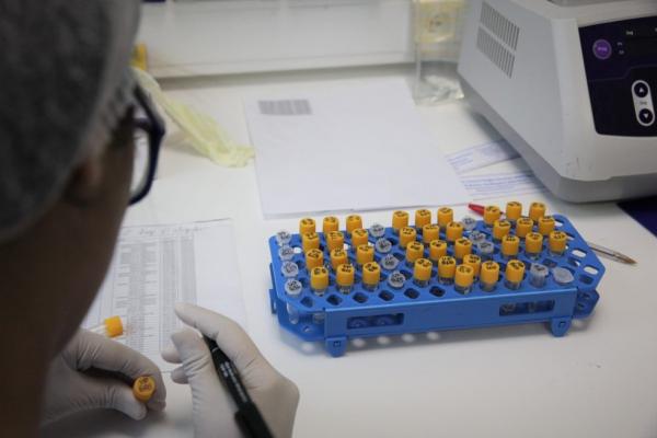 Exame Covid-19 coronavírus laboratório teste.(Imagem:Odair Leal/ Secom)
