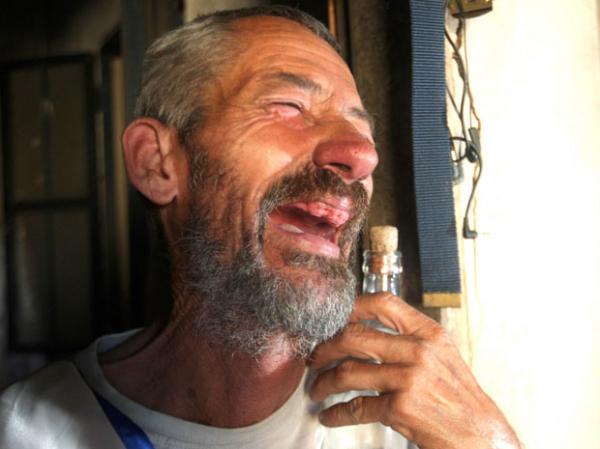 Jos&eacute; Neto da Silva, conhecido como 'su&atilde; de borboleta', foi eleito o homem mais feio do Brasil.(Imagem:Alex de Jesus / O Tempo / Futura Press)