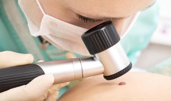 Por ano, cinco mil pacientes são diagnosticados com câncer no Piauí