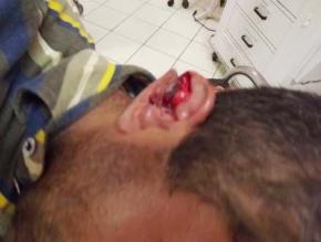 Homem corta a orelha do sogro após fim do relacionamento no PI