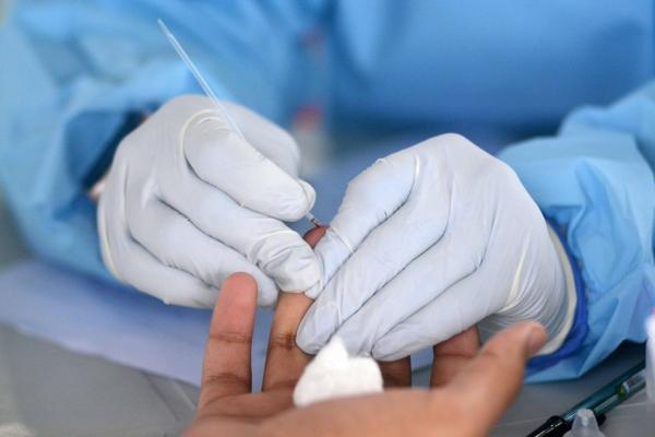 Piauí registra 809 novos casos e seis mortes por Covid-19 nas últimas 24 horas