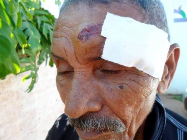 Idoso de 80 anos é atingido com golpes de facão pelo próprio filho no Piauí