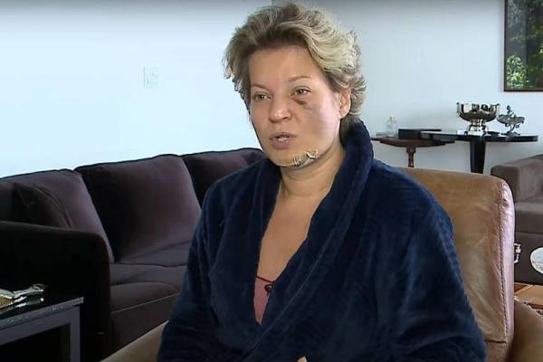 Polícia Civil do DF conclui que deputada sofreu queda e não foi agredida