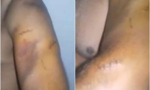 Mototaxista é esfaqueado durante assalto na zona Sul de Teresina