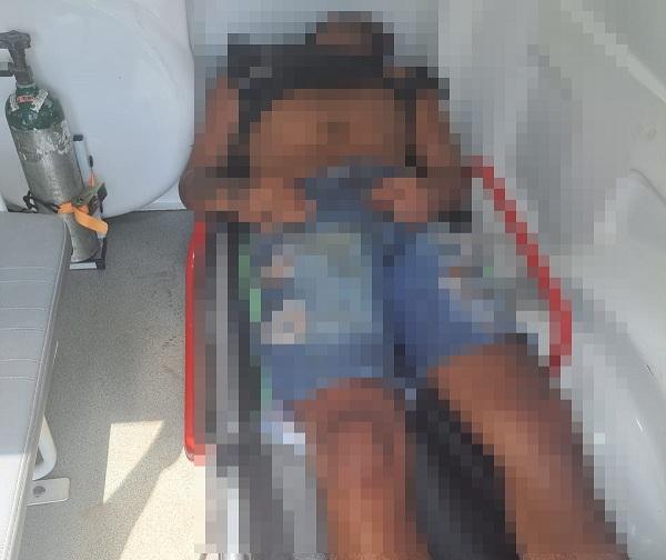 Jovem é espancado e baleado na cabeça; vítima estaria com olhos perfurados