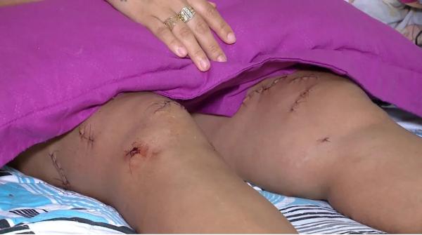 Esteticista que sofreu 19 facadas conta que ex se passou por entregador para acessar sua casa