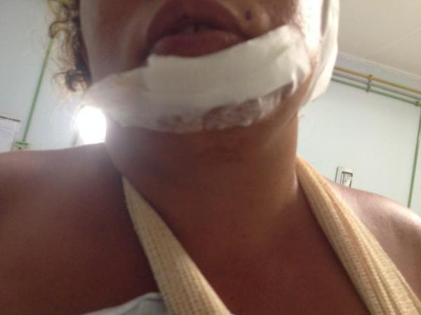Mulher esfaqueada pelo ex já tinha procurado a polícia três vezes