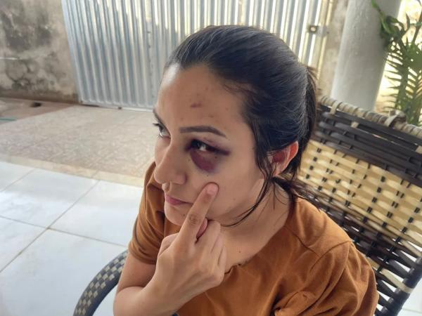 Enfermeira diz que foi agredida com cabeçadas pelo ex, servidor do TJ-PI