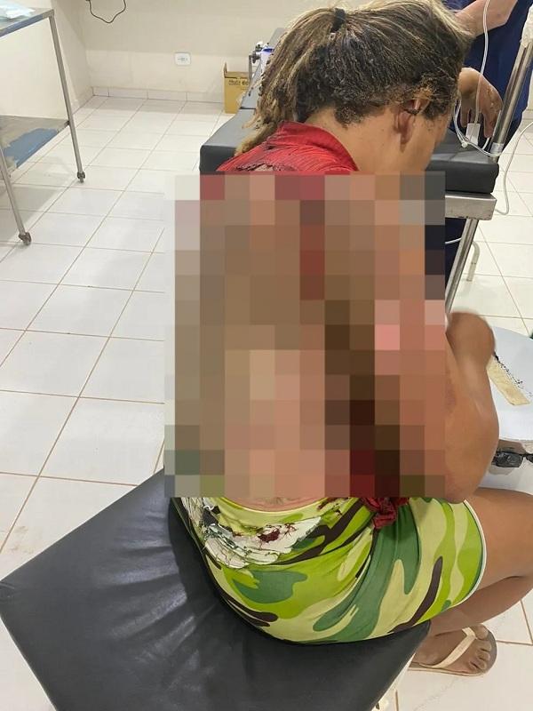 Homem é preso por jogar gasolina e atear fogo na companheira enquanto ela dormia no interior do PI