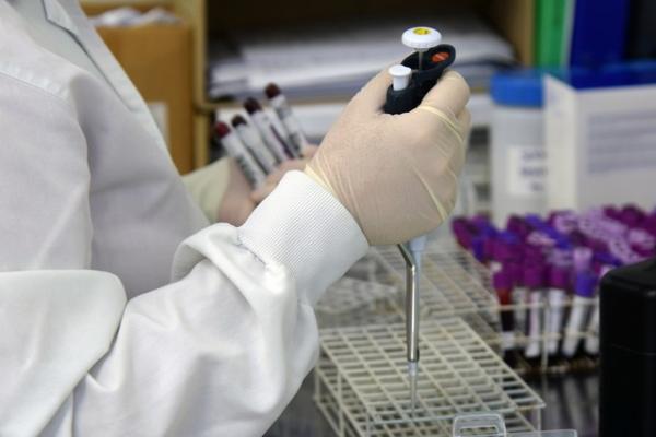 Lacen-PI prioriza exames para casos urgentes de Covid-19 após desabastecimento de materiais