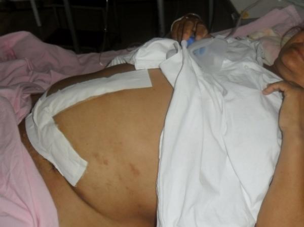Cirurgia reparat&oacute;ria na bexiga da paciente durou cerca de seis horas, diz fam&iacute;lia. (Imagem:Avem/MS)
