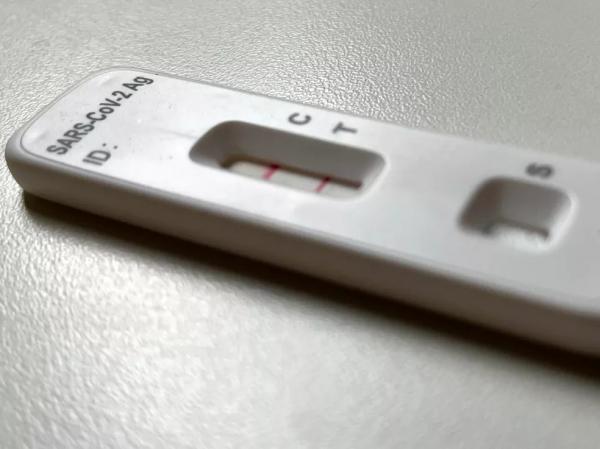 Piauí registra quase 1 mil novos casos de Covid-19 e 9 mortes pela doença nas últimas 24 horas